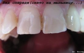 Эстетическая стоматология Харьков
