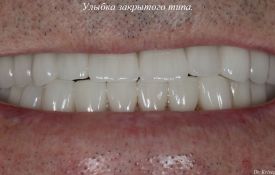 Эстетическая стоматология Харьков